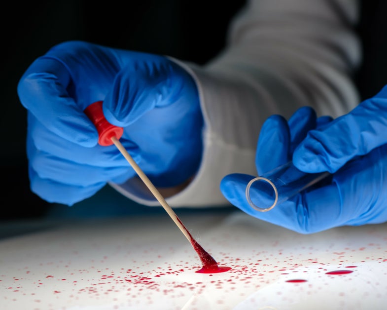 Forensic Technician shows swabs to remove DNA at the scene after a crime