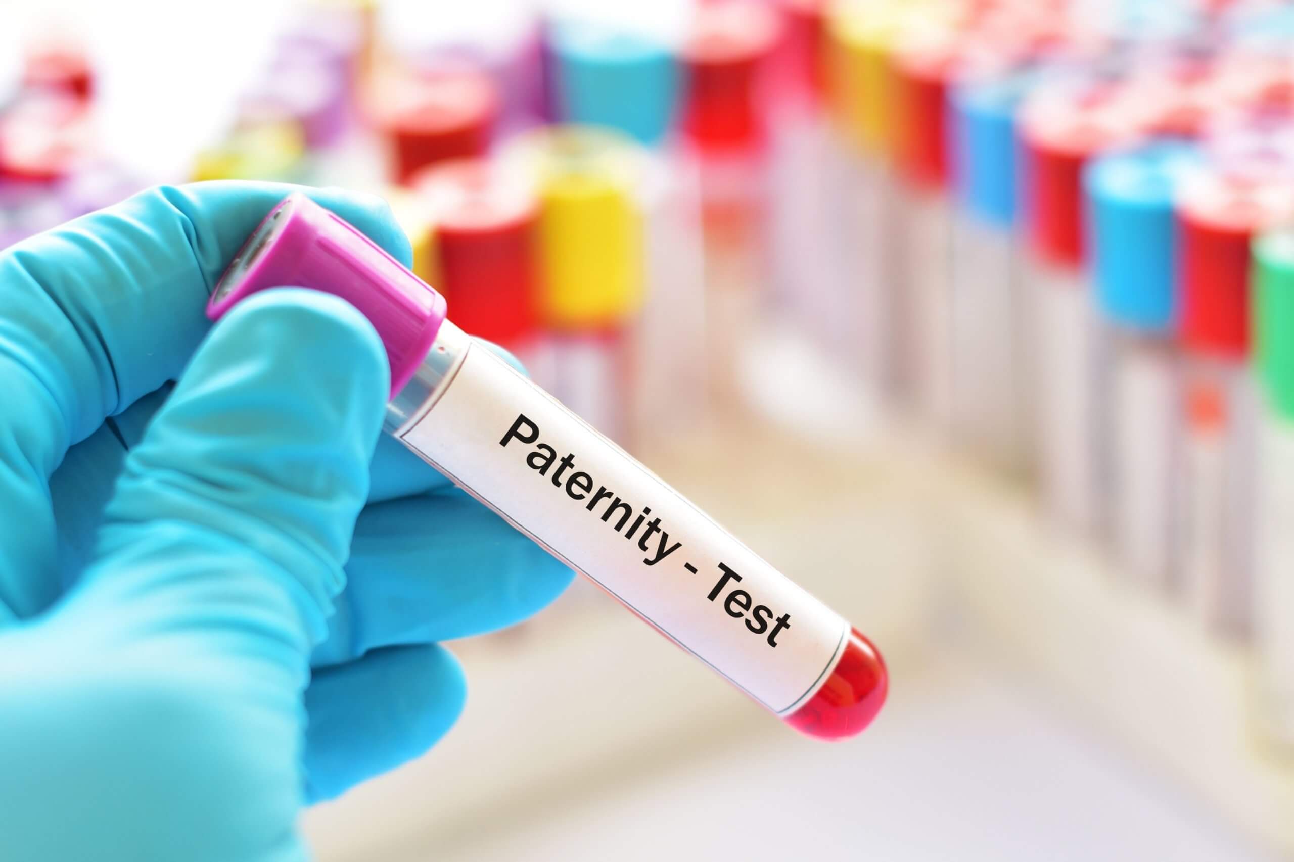 Lab Technician Hold Test Tube for Paternity Test