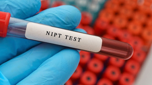 NIPT Test